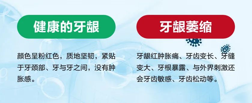 如何判斷自(zì)己是否有牙龈萎縮的症狀呢(ne)？其實通過對(duì)比就能(néng)發現(xiàn)